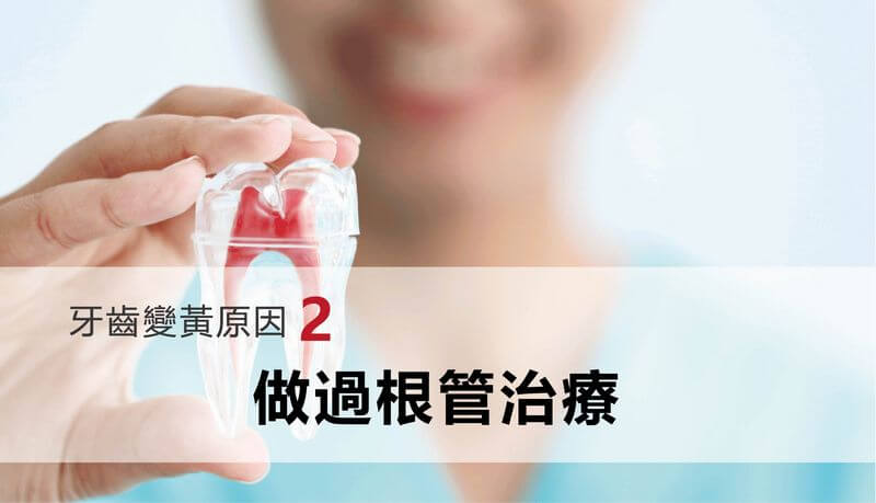牙齒變黃原因-根管治療導致牙齒鈣化
